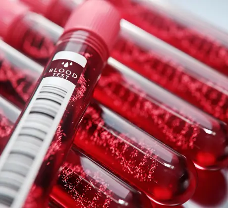 Otvorenie hematologickej ambulancie