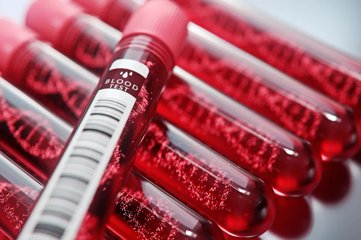 Otvorenie hematologickej ambulancie